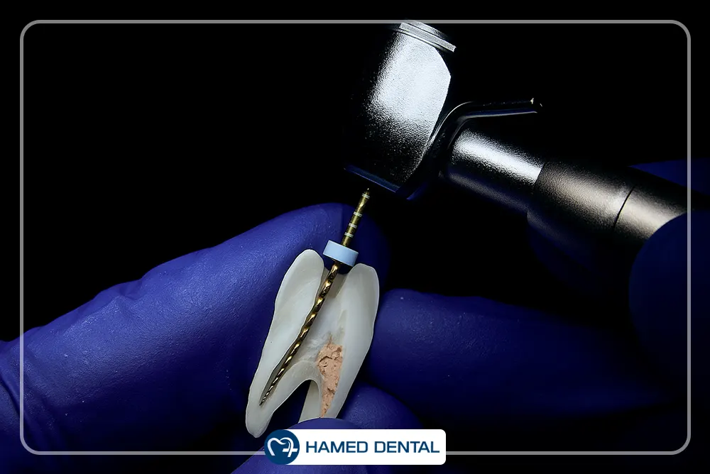 تجهیزات اندودانتیکس