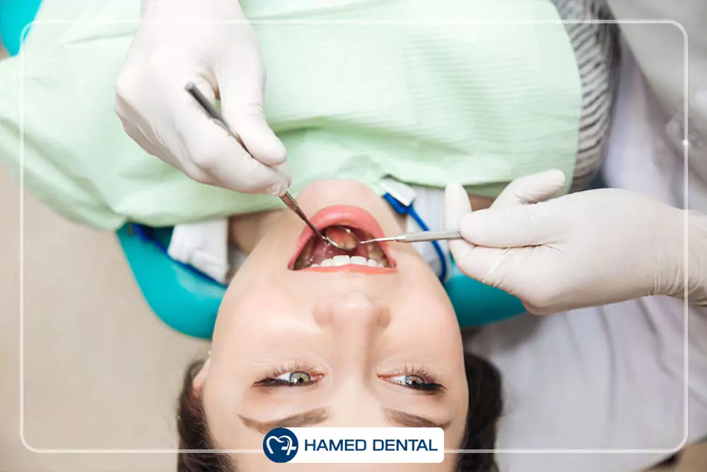 آمالگام و آمالکپ دندانپزشکی