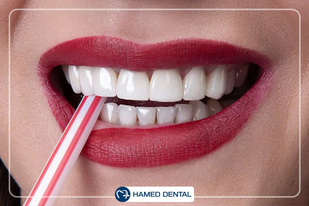 کامپوزیت دندانپزشکی