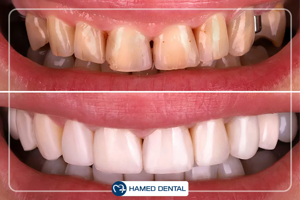 محصولات ترمیمی و زیبایی دندان