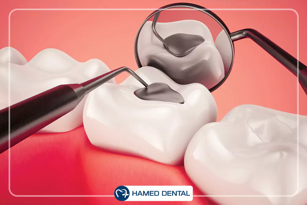 مواد ترمیمی دندانپزشکی
