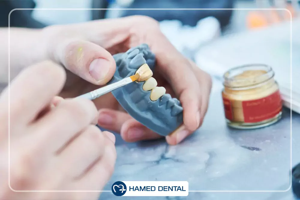 مواد ترمیمی دندانپزشکی